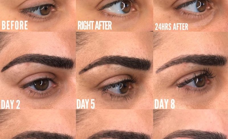 Progression of eyebrow healing and growth over 8 days.